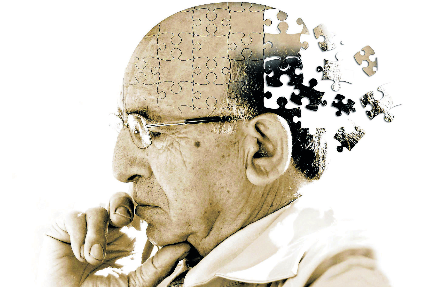 Khái niệm bệnh Alzheimer