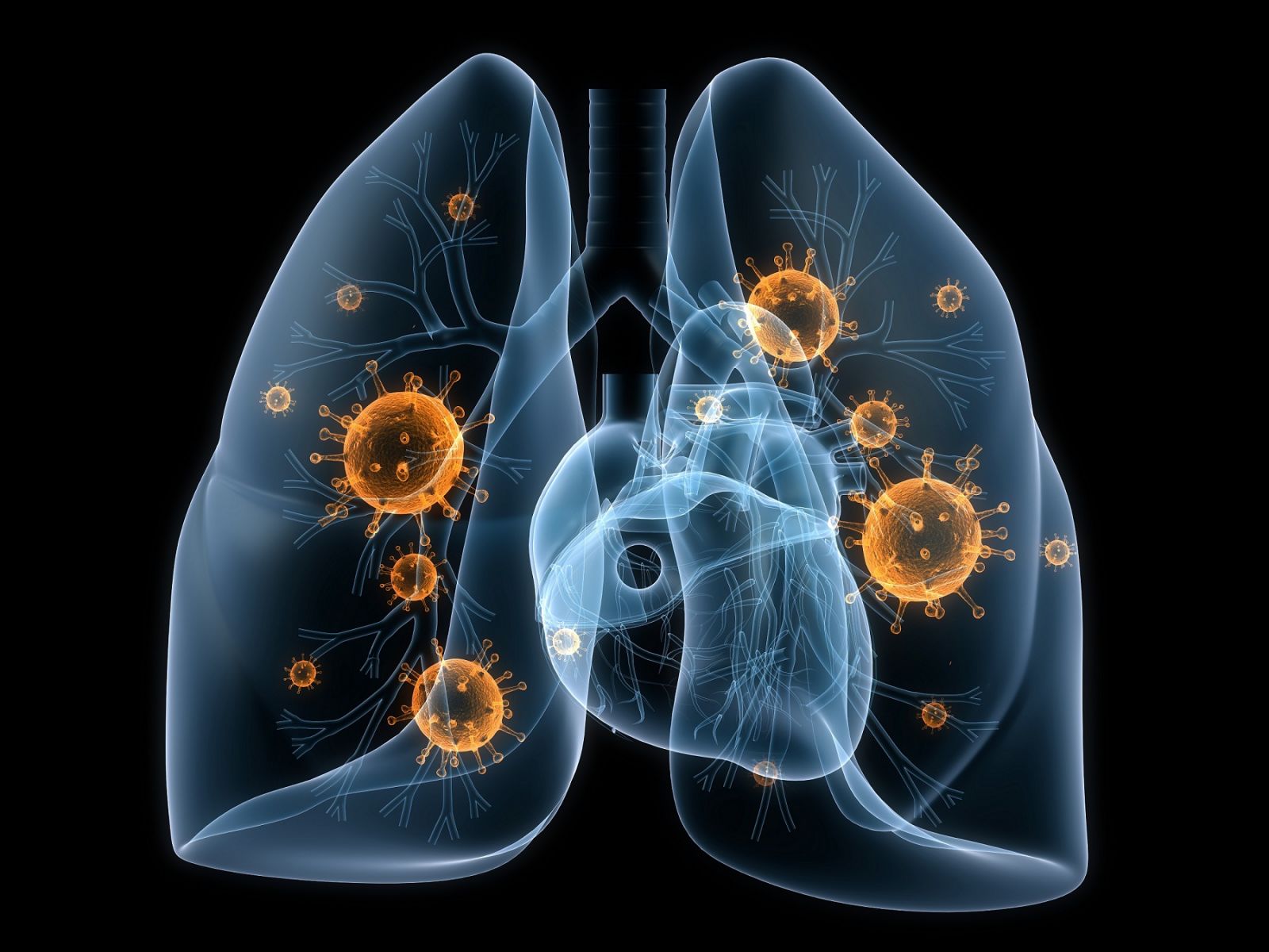 Bệnh viêm phổi ở người lớn tuổi